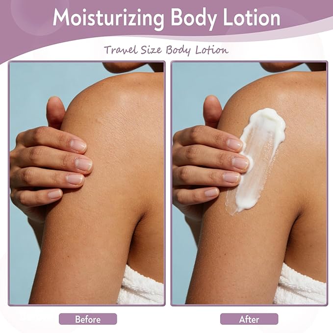 Travel Body Lotion, Individually Wrapped Hand Cream Lotion Bulk, Nourishing Extra Dry Skin Mini Small Packet Size Shower Moisturizer Lotion Toiletries for Travel, Hotel Homeless 0.34 oz (Pack of 100)