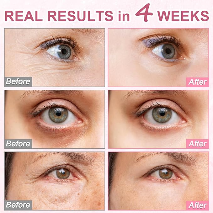 5% Caffeine Eye Serum,Hyaluronic Acid & Niacinamide, Under Eye Cream for Dark Circles, Anti Aging 360° Massage Rollerball - Reduce Puffiness, Wrinkles & Fine Lines, 0.5 fl. oz (Scented)