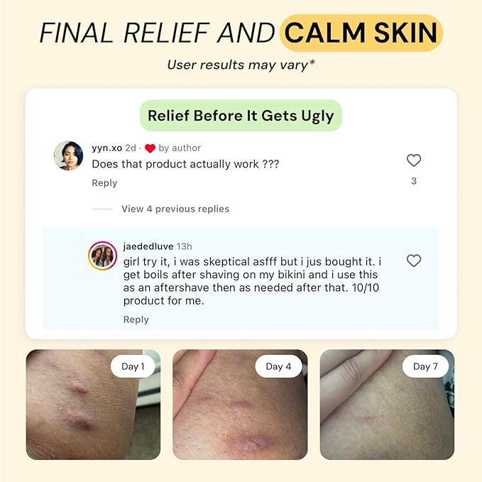 MyMagicHealer Universal Flare Care | Drawing Salve for HS, Boils, Cysts, Hemorrhoids, Pilonidal Cyst, Abscess | Anti-Chafing, Wound Care, Relief for Itching Skin w/Propolis & Egg Yolk Extract 1 oz