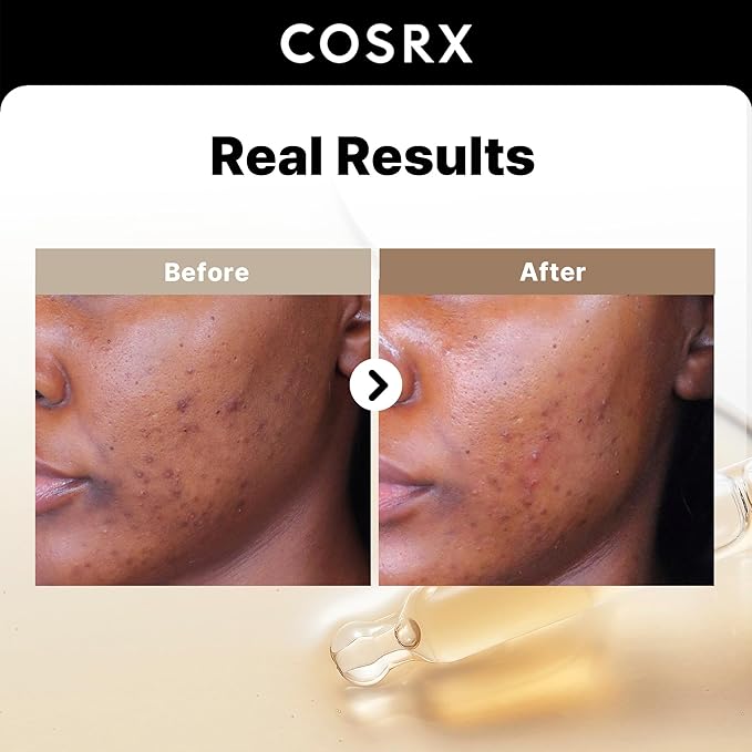 COSRX Vitamin E Vitalizing Face Sunscreen SPF 50 + 2% Alpha Arbutin Discoloration Care Serum