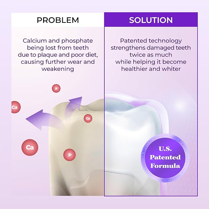 HIMALAYA PINKSALT Purple Toothpaste - Deep Stain Remover with Fluoride, Plaque Remover, Appropriate for Sensitive Teeth, Peroxide Free - Vanilla Mint, 3.5 oz (Pack of 3)