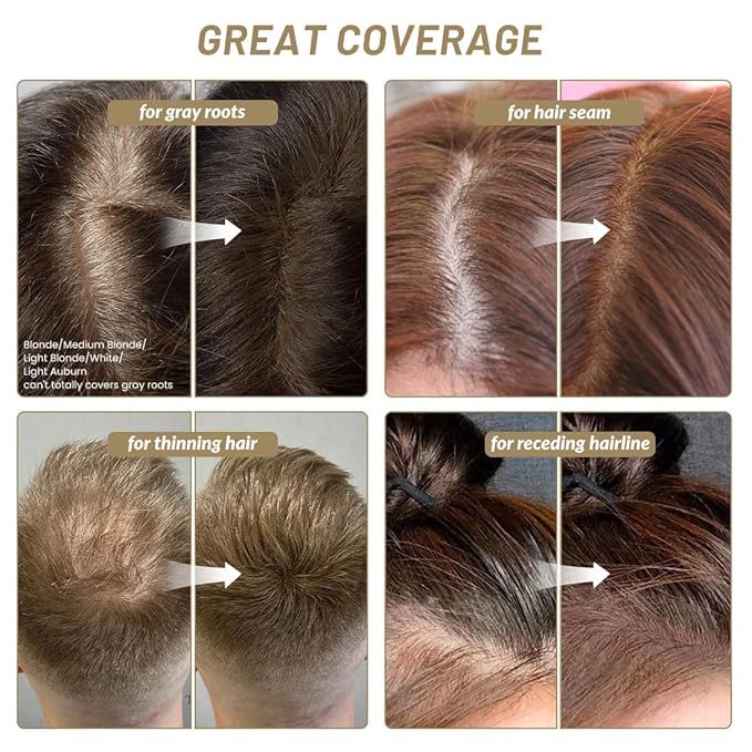 VOLLUCK Root Touch up Powder, Instant Hairline Powder for Thinning Areas and Gray Hair Coverage, Natural and Non-greasy Root Cover up for Women and Men (Light Brown, 0.35 Ounce)
