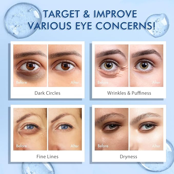 Advanced Eye Serum with 5% Caffeine & Retinol Hyaluronic Acid Niacinamide Eye Treatment Cream for Puffy Bags Dark Circles Fine Lines Under Eyes Serum with 360°Massage Roller Ball 15ML/0.5 fl.oz