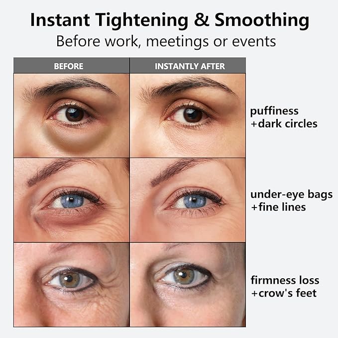 Instant Eye Tightener, Temporary Tightener, Reduces Eye Bags, Wrinkles, Puffiness, Dark Circles and Crow's Feet in 3 Minutes, Anti-Aging, Firming and Hydrating Triple Effect 1 Fl oz (Pack of 1)