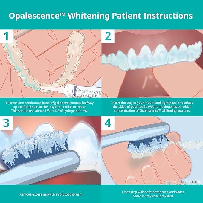 Opalescence 35% CP Mint - Gel Syringes Teeth Whitening - Refill Kit (4 Syringes Total) Carbamide Peroxide Gel. Made by Ultradent. Tooth Whitening Refill Syringes 5197-2
