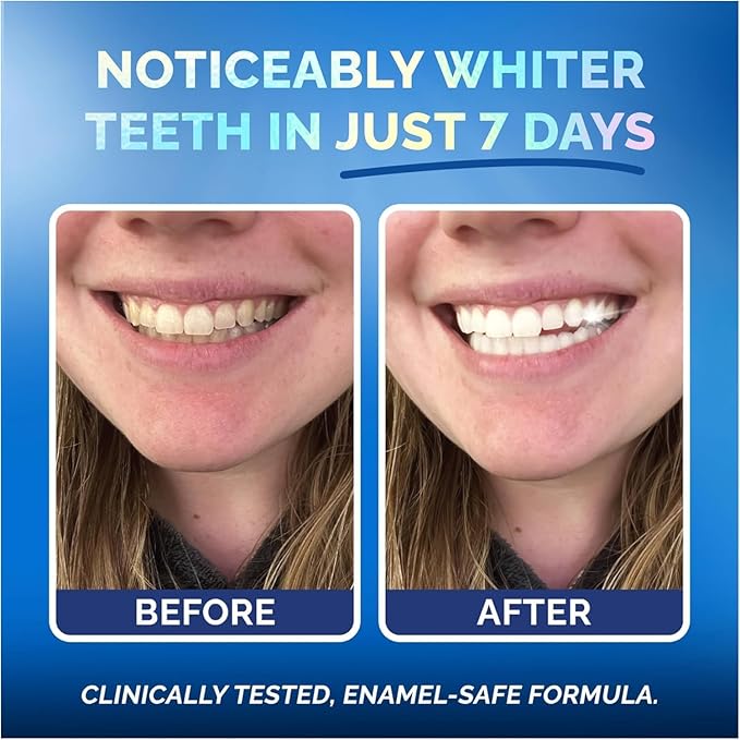 Teeth Whitening Strips for Sensitive Teeth and Gums - Peroxide Free and Enamel Safe with Coconut Oil for Whiter Teeth - 7-Day Treatment White Strips with Non-Slip and Dry-Strip Technology