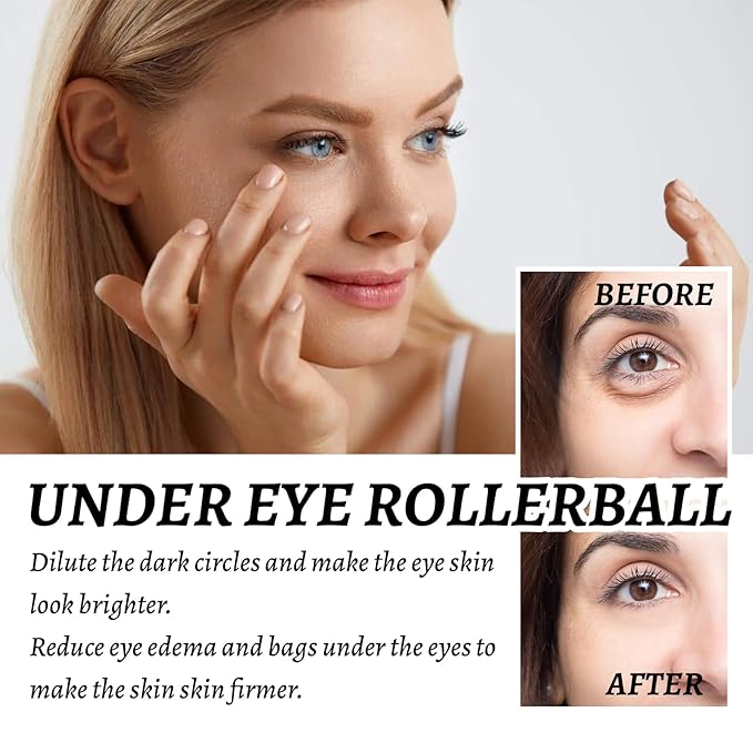 Eye Roller for Puffy Eyes, Castor Oil and Frankincense Eye Roller for Dark Circles, and Wrinkles, Anti Aging Eye Serum Cream, Glass Bottle, 2 PCS