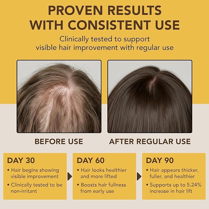 Botanic Hearth Batana Oil for Hair Growth & Hair Treatment Oils | Dr Sebi Inspired, 100% Raw & Pure Batana Oil | Scalp & Hair Treatment for Thickness & Strength | All Hair Types | 4 fl oz