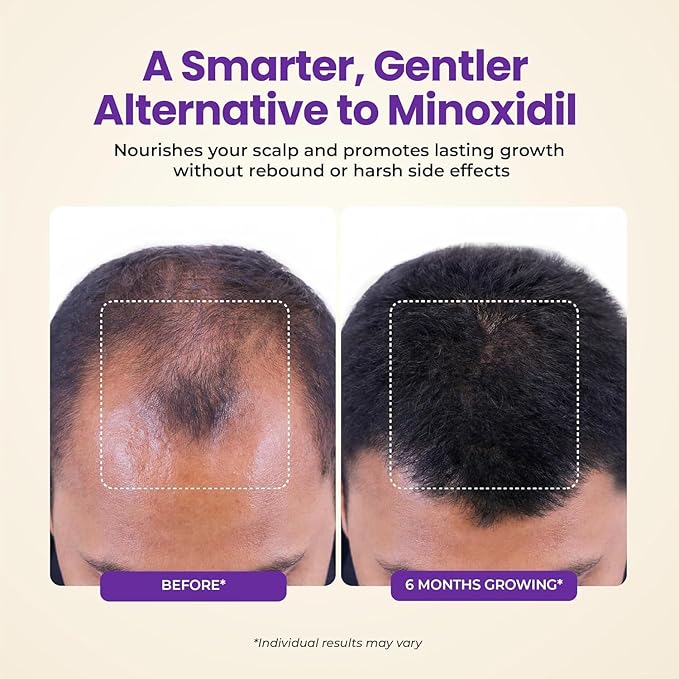 Hair Growth & Thickening Serum With Biotin & Rosemary + Multi-Benefit Treatment for Thinning Hair, Breakage & Split Ends, Boosts Density, Repairs Damage, Hydrates Dry Scalp - For Men and Women, 1 Pack