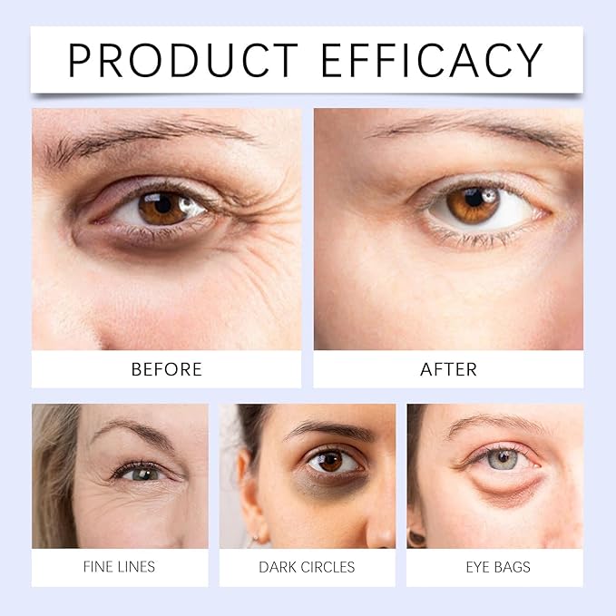 Soelegant Coffee Beef Tallow Eye Cream for Dark Circles, Beef Tallow for Skin Caffeine Eye Cream, Organic Grass Fed Beef Tallow Eye Treatment Reduce Puffiness Anti-Aging Under Eye Cream