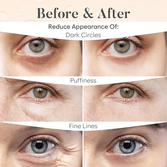 BLOOMORA Caffeine Under Eye Patches (30 Pairs) - Dark Circles & Puffiness Care - Hydrating Caffeine Eye Mask