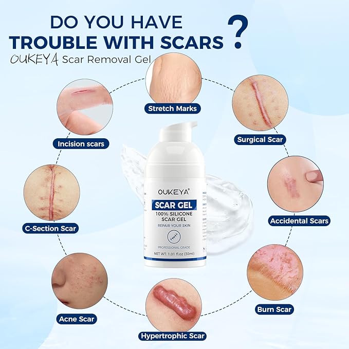 OUKEYA Silicone Scar Gel - 100% Silicone Cream Perfect for Sensitive Skin, Say Goodbye to Old and New Scars (30ml)