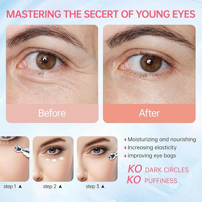 Instant Reduction of Eye Bags-Retinol Eye Cream Dark circles,Relieves Dark Circles And Puffiness, Youth Eye Cream: Smooth Wrinkles,Hydrating, Tightens The Delicate Skin Under The Eyes 0.7 OZ -U
