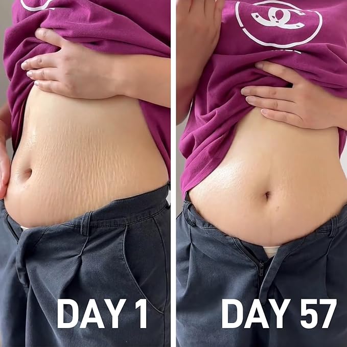 Stretch Mark Oil for Pregnancy & Body Oil for Pregnant Women, Morocco Nut Oil Help for Scars & Stretch Marks Removal & Prevention, Belly Cream for Repair, Firming & Smoothing Fine Lines (1Pack/50ml)