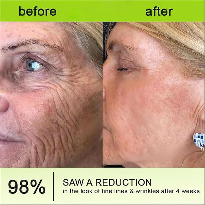 Celestvera Botoxmix Cream,Anti-Wrinkle Cream,Wrinkle Anti New Pore Minimizer Cream, Lift Tightening Retinol Booster, Retinal Serum, Advanced Body Lotion Bottle 1PCS
