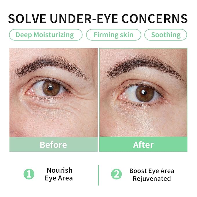 Bio-Collagen OK Eye Mask, Firming & Hydrating Gel Under Eye Patches for Puffy Eyes and Dark Circles, Deep Moisturizing & Soothing Eye Mask for Women and Men - 18 Pairs, Calm Green