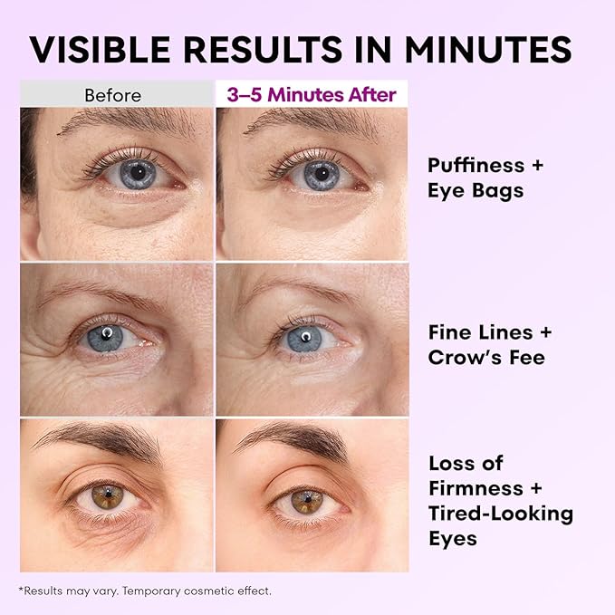 RONKIE Instant Firm Eye Tightener: Upgraded Formula for Women Helps Reduce Eye Bags Puffiness and Wrinkles in 3-5 Minutes When Time Matters 0.67 oz