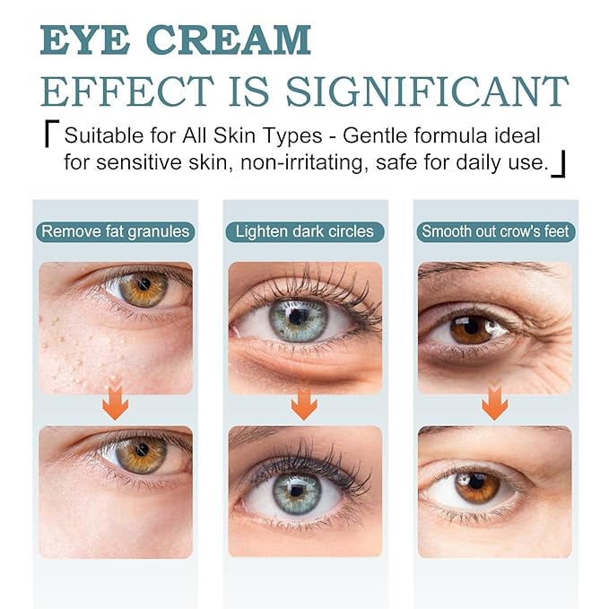 Temporary Tightener Eye Cream-Instantly Reduces Under- Bags, Dark Circles & Wrinkles, Anti-Aging with Retinol & Hyaluronic Acid, Under Eye Creams Suit Women Men Firm Smooth firming Non-Greasy-ABCNBA