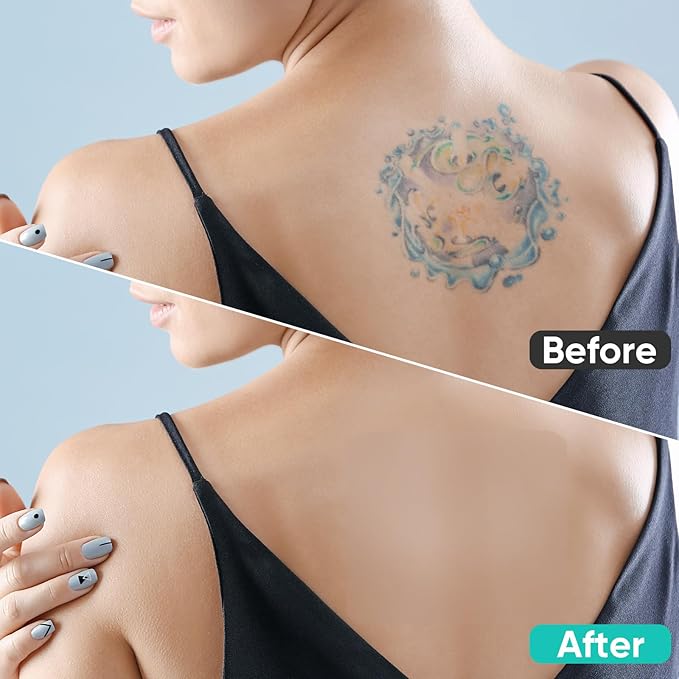 Tattoo Cover Up Patch - Ultra-Thin Waterproof & Breathable Stickers | Conceal Tattoos, Scars, Birthmarks | Invisible, Skin-Friendly, Long Lasting Adhesive Tape (6 Pcs)
