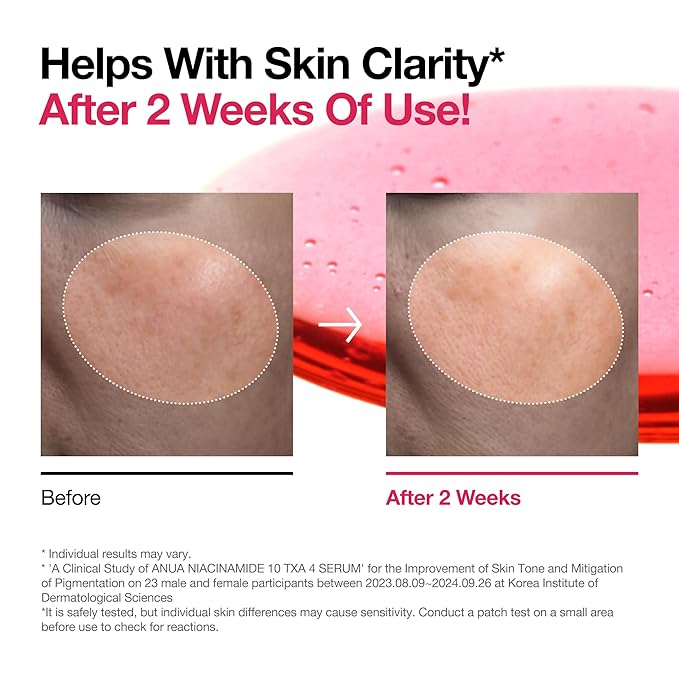 Anua 2% BHA + 10% Niacinamide Skin Booster Duo - 10% Niacinamide + 4% Tranexamic Acid Serum for Dull Skin, Gentle Exfoliating Toner, Salicylic Acid, for pore Control, Korean Skincare set
