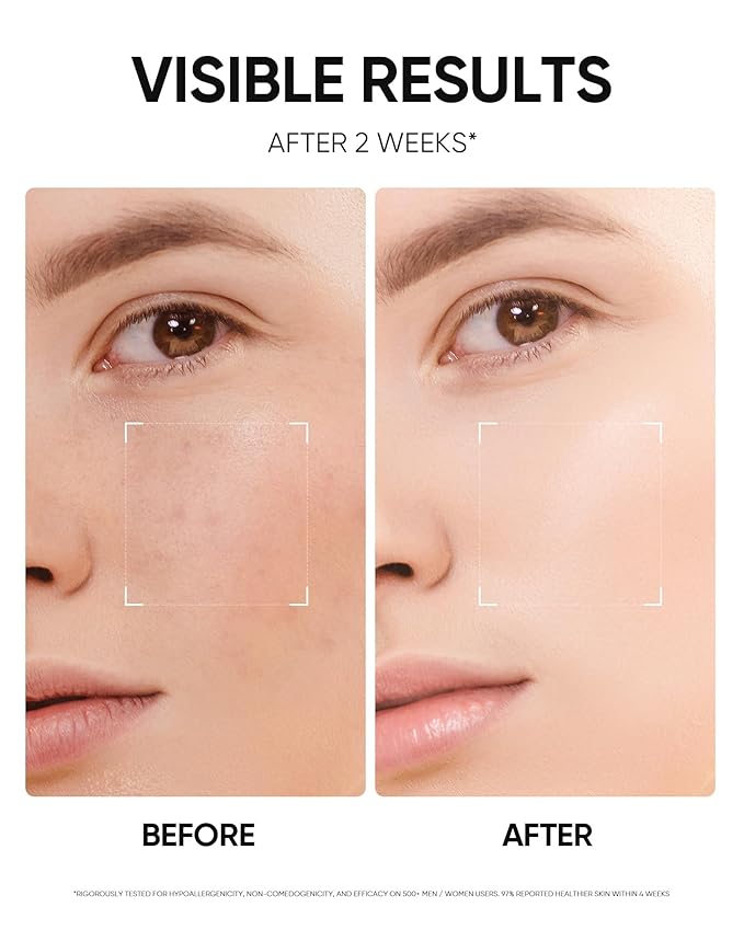 MSH Niacinamide Brightening Cream,Fades Dark Spots, Evens Skin Tone, Tranexamic Acid, α-Arbutin, 5X Ceramides, Centella Asiatica, Suitable for Oil and Acne-prone skin, 3.52fl.oz / 100g
