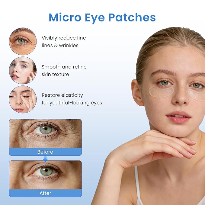 Micro-Dart Under Eye Patches for Puffiness, Dark Circles & Fine Lines | Hyaluronic Acid, Retinol, Collagen, Peptides, Vitamin C & Niacinamide | Korean-Inspired Eye Care (8 Pack)