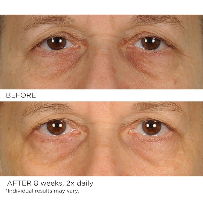 NASSIFMD Under Eye Smoother Firming Cream, Anti-Aging Eye Cream for Dark Circles, Puffiness & Wrinkles
