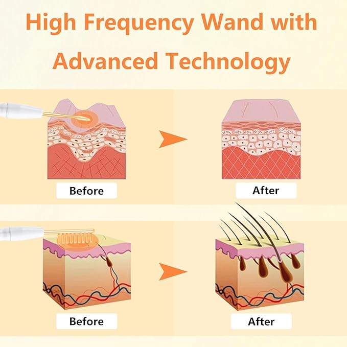 High F Rrequency Facial Wand for Face Care, Multi-Function Face Device Machine