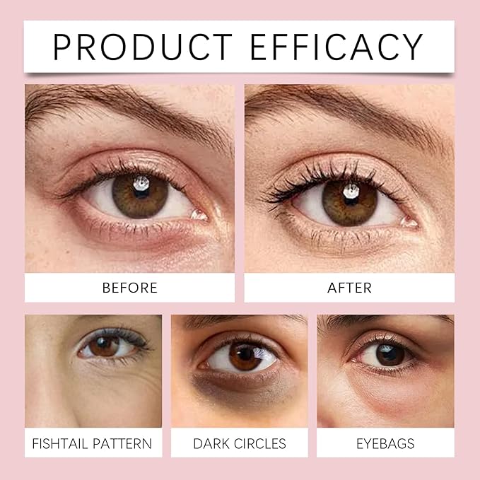 Eye Patches With Caffeine & Hyaluronic Acid,Helps Reduce Look Of Dark Circles, Puffiness & Fine Lines,Deep Hydrating Anti-Wrinkle Eye Pads,1BOX(3 Pack)