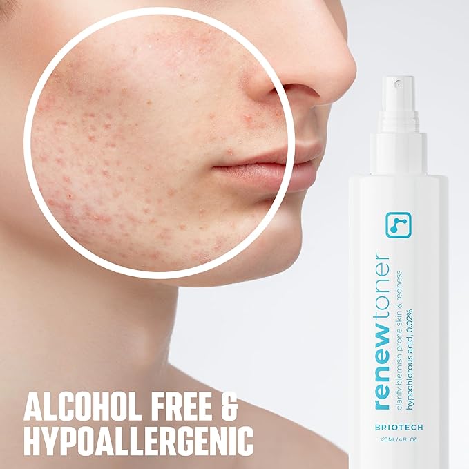 BRIOTECH Renew Toner, Hypochlorous Acid Spray, Minimize Appearance of Blemishes, Soothing Facial Mist for Sensitive Skin, Calm Redness & Bumps, Vegan, 2 fl oz Travel Size (2 Pack)