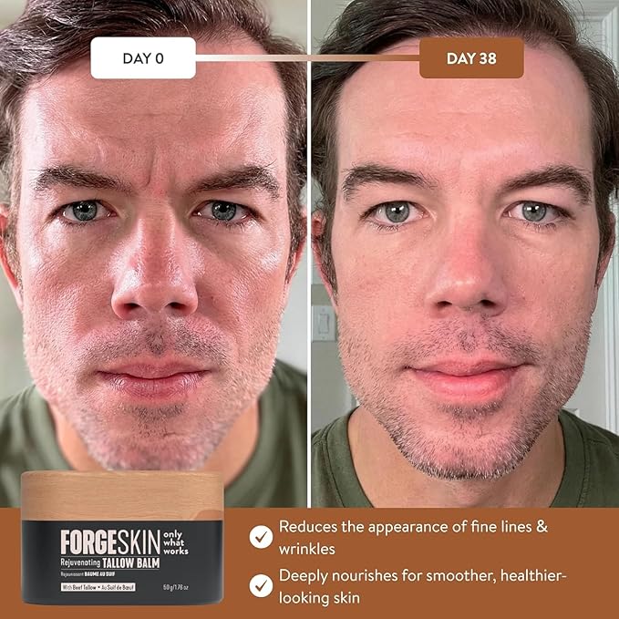 Forge Skin® Wrinkle Defense Beef Tallow Balm for Men [TALLOW-BASED] Moisturizer for Face Hydration - Hydrating AntiAging Skin Cream Natural Facial Skincare Lotion with Essential Oils (1.7oz Each) 3pk
