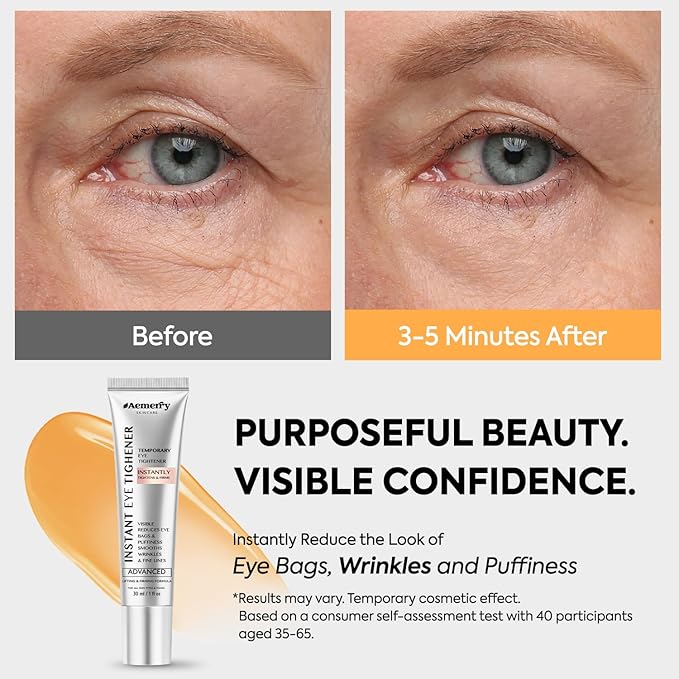 Instant Firm Temporary Eye Tightener: Advanced Tightening & Lifting Cream With Brush For Eye Bags, Wrinkles, Puffiness, Fine Lines – Lightweight, Easy Wear Formula, Gentle For All Skin Types. 1 Oz