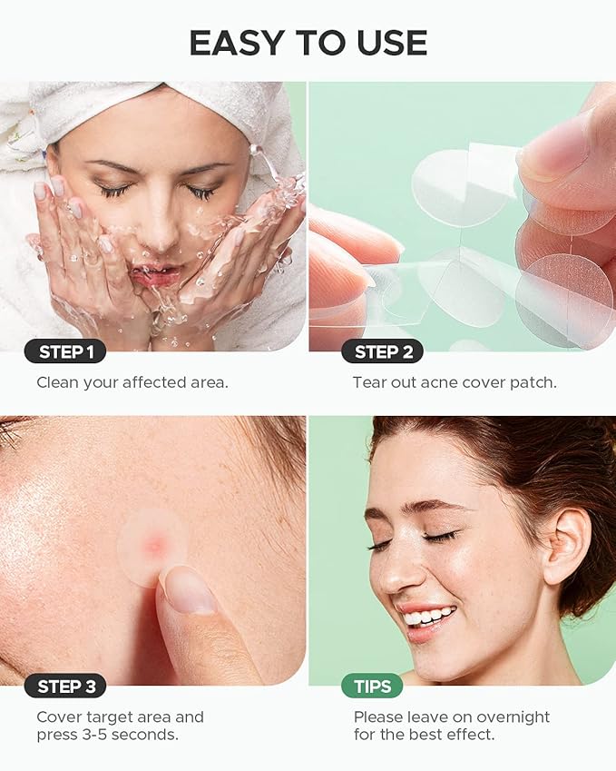 Pimple Patch (360 Counts 4 Sizes), Hydrocolliod Acne Patch for Face, Invisible Zit Patch with Tea Tree Oil & Calendula Oil, Blemish Patch