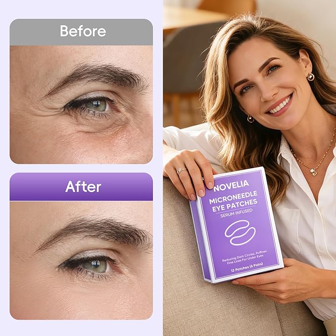 NOVELIA Micro Eye Patches with Hyaluronic Acid & Vitamin C, Hydrating Eye Masks for Dark Circles & Puffiness, Smoothing & Firming Under Eye Care, Individually Packed, 12 Patches (6 Pairs)