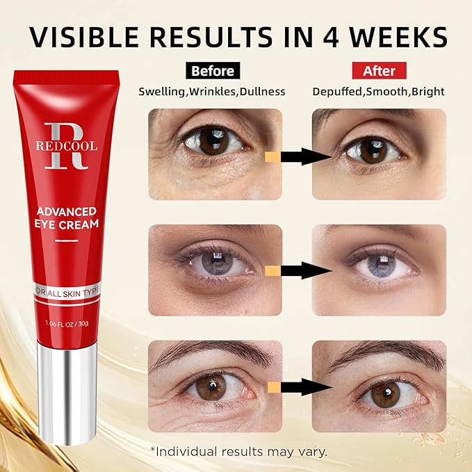 Retinol Eye Cream for Dark Circles, Anti-Aging Eye Cream with Hyaluronic Acid & Caffeine, Reduces Wrinkles, Puffiness & Fine Lines, Day and Night Use, 1.06 fl oz