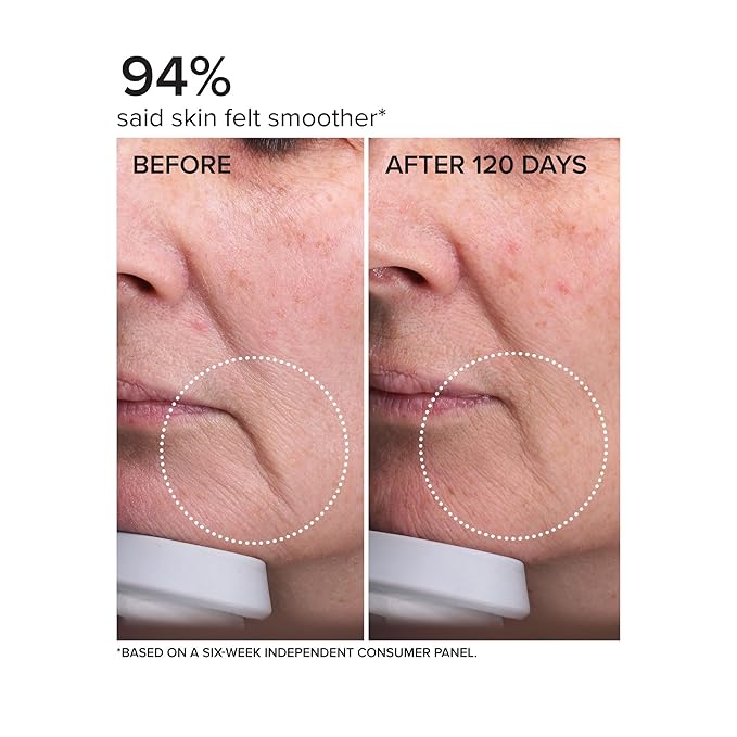 DRMTLGY Needle-less Serum - Anti-Aging Serum for Fine Lines & Wrinkles - Niacinamide with Potent Blend of Hyaluronic Acid, Peptides & Ceramides, 1 fl oz