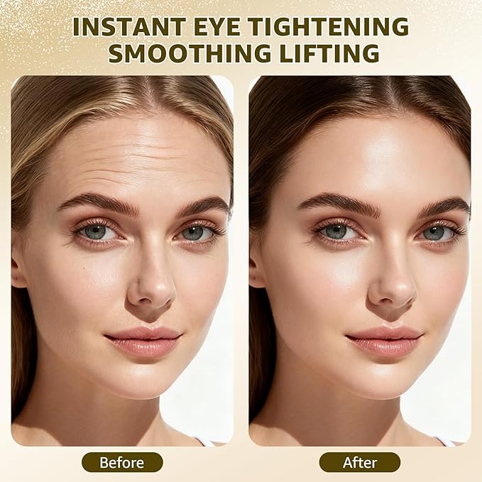 15S Instant Eye Tightener Cream, Firmx Eye & Face Cream Temporary Eye Tightener for Eye Bags, Puffiness & Wrinkles, Dual-Action Firming & Long-Term Repair with 5000ppm PDRN, Panthenol, 0.71 Fl Oz