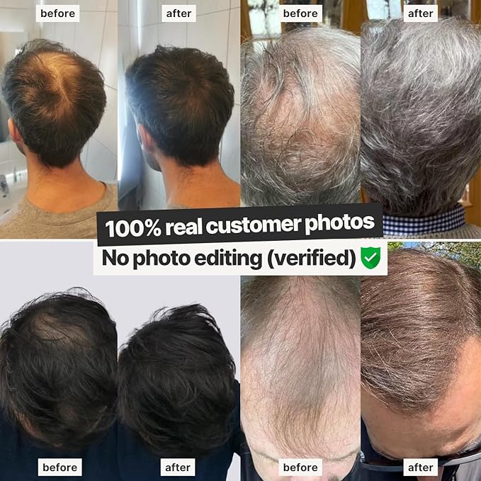 IMPERIO Hair Building Fibers for Thinning Hair - 26g Premium Hair Fibers for Women & Men in Hairdresser Quality - Hair thickening in less than 20 seconds (Light Brown)