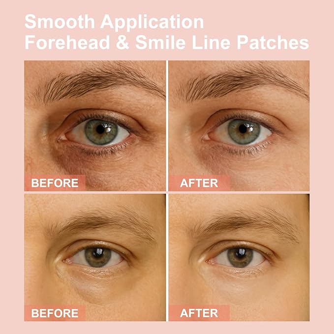 Micro Eye Patches, Under Eye Patches for Puffy Eyes, Dark Circles & Fine Lines, Deeply Hydrating Anti-Wrinkle Patches, Smooth Application Forehead & Smile Line Patches (1)