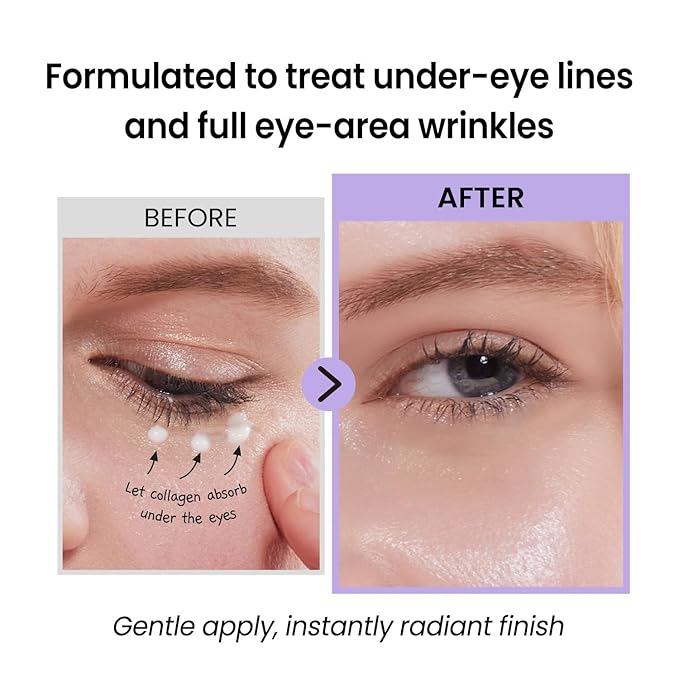 coxir Black Snail Collagen Eye Cream – Firming & Hydrating Snail Mucin, Collagen & Niacinamide for Puffiness, lifting & Dullness under eyes area | Korean Eye Treatment (30ml)