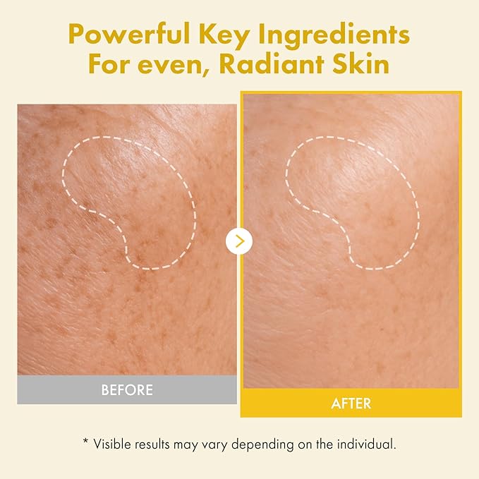 TOSOWOONG Real Kojic Acid Turmeric Fit, Dark Spot Wrapping Mask, Vitamin C & Glutathione Peel Off Facial Mask for Even Tone, Elasticity, Hydrating, Glow, Glass Skin, Korean Skincare, 50ml/1.69 fl. oz.