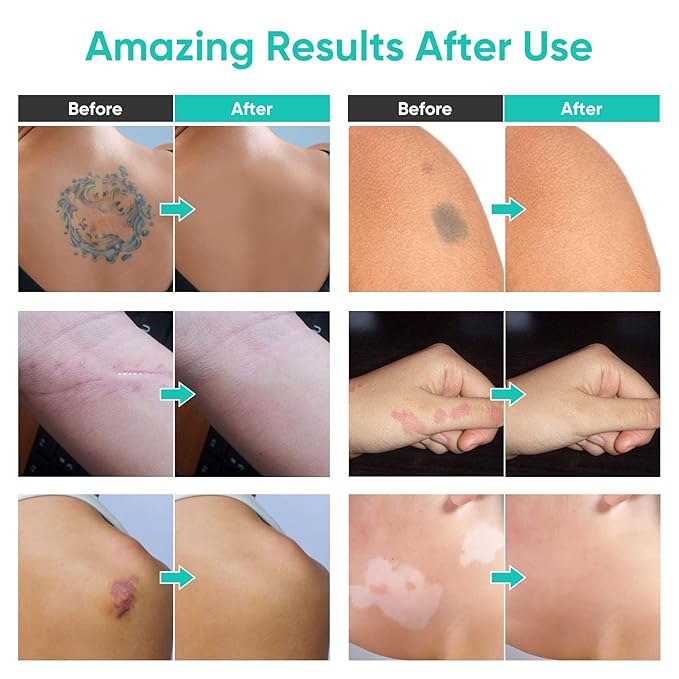 Tattoo Cover Up Makeup, Waterproof Concealer, 2 Colors, Professional Scar & Blemish Coverage for Tattoos, Birthmarks, and Scars, Long-Lasting, Adjustable Formula for Men & Women