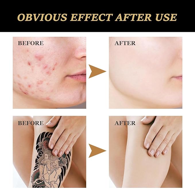 Tattoo Cover Up, Invisible Waterproof Concealer,Long Lasting Professional Skin Makeup Concealer Kit for Body Leg Tattoo,Gift for Men and Women,2 Colors