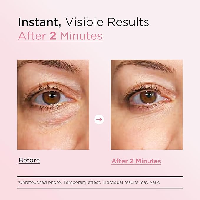 VELAMO ADVANCED Instant Eye & Face Lift Cream: Rapid Under Eye Bags Wrinkles Smile Lines Forehead Lines Remover - Temporary Firming & Tightening Treatment in 2 Minutes 1 OZ/30g
