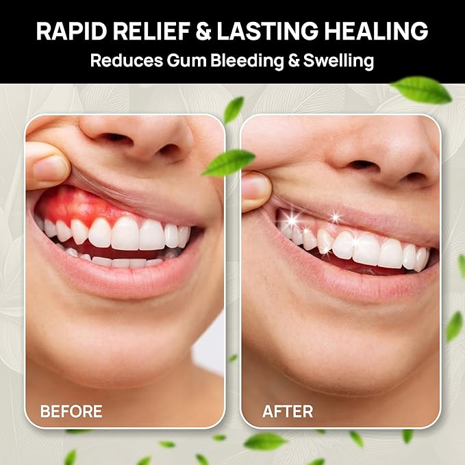 The Goodbye Company Healthy Gum Rinse – Handcrafted Natural Mouthwash for Bleeding Gums, Receding Gums & Fresh Breath | Organic Herbal Blend with Essential Oils | Small Batch Made in Florida