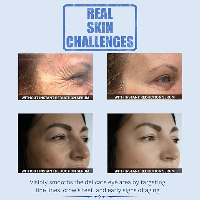 Rapid Reduction Eye Serum | Fast-Acting Wrinkle & Undereye Bag Tightening Formula | Minimizes Dark Circles & Fine Lines Instantly | For Men & Women | 20ml (0.68 fl oz)