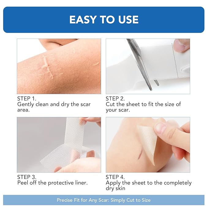 Clear Silicone Scar Sheets, Silicone Scar Tape(1.6"x 120" Roll-3M) - Reusable, Soft & Medical Grade Adhesive Tape for Old & New Scars, C-Section, Surgery, Keloid & Acne Scars