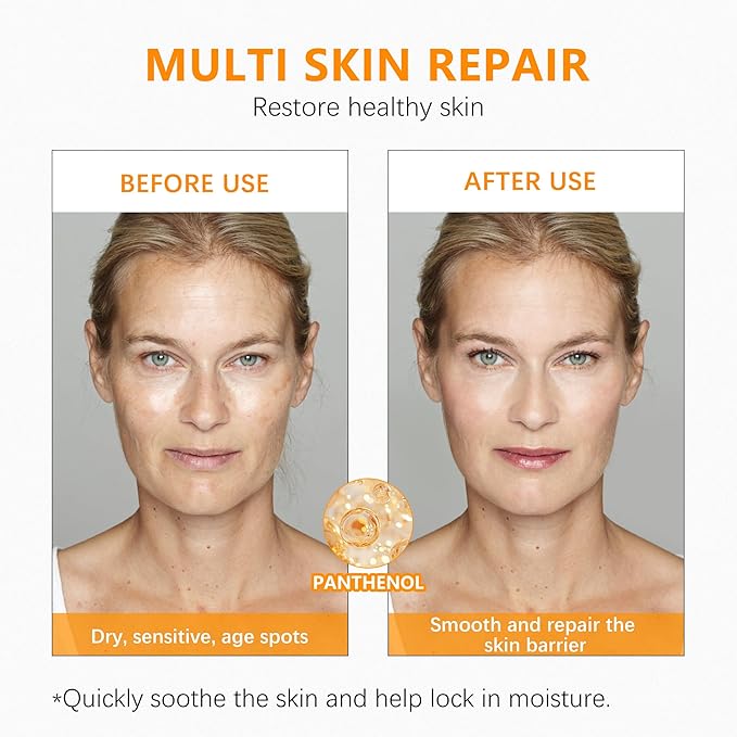 Super Vitamin C Serum for Women over 70 With Hyaluronic Acid, Reduce Wrinkle, Hydrates, Firms, Lifts, Anti Aging Serum for Dark Spots, Wrinkles, DullSkin, 1 fl.oz.