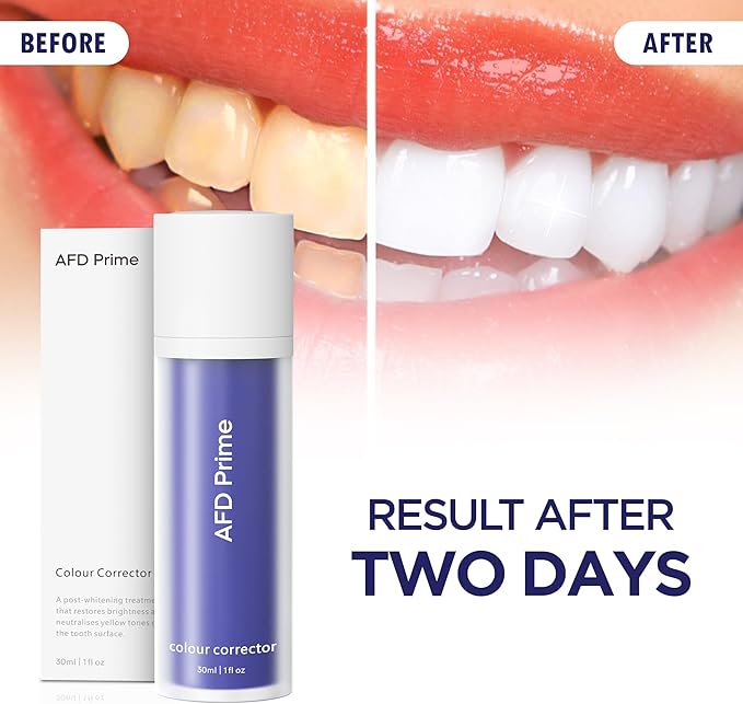 AFD Prime Purple Toothpaste for Teeth Whitening, 130g (4.58 oz) – Purple Color-Correcting Toothpaste to Reduce Yellow Tones, Peroxide-Free, Enamel-Safe, Mint Flavor, Suitable for Daily Use
