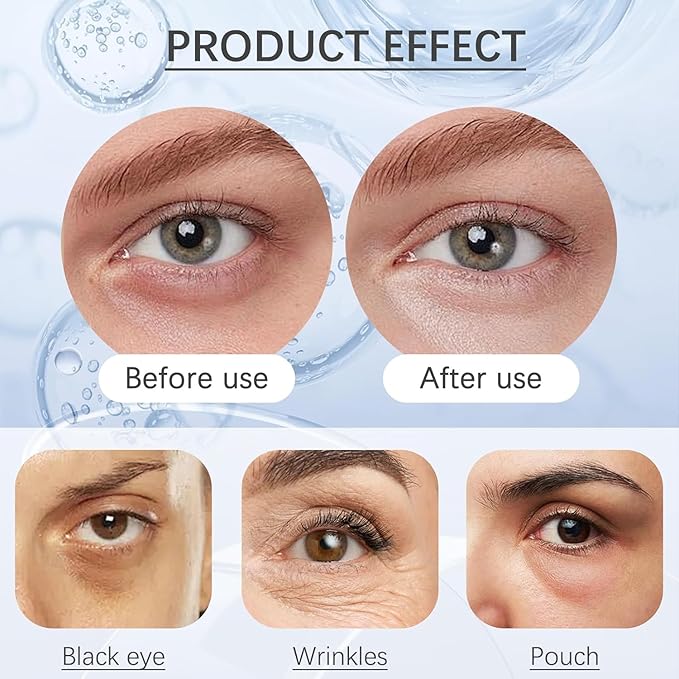 Water Ice Levin 2PCS Calcium Multi Balm, Calcium Volume Multi Balm, Wrinkle Removal Stick, Collagen Moisturing Stick, Anti-aging, Hydrating, Firming Skin, Suitable for Eyes, Face, Neck